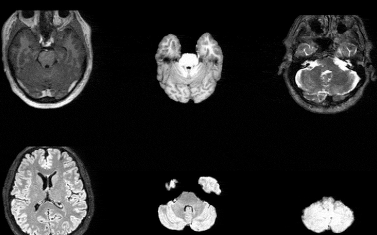 Article image for Synthesize Realistic 3D Medical Images at Scale to Ship Pre‑Trained Models