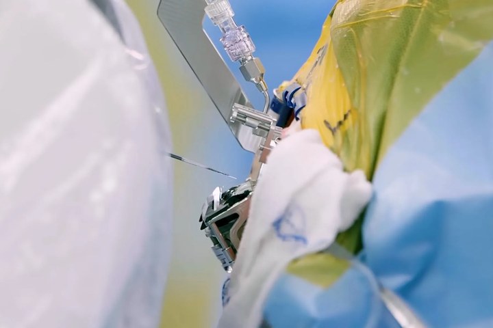 Article image for Elon Musk's Brain-chip Startup Aims for Scalability with New Transdural Procedure