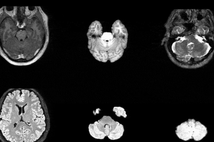 Article image for Synthesize Realistic 3D Medical Images at Scale to Ship Pre‑Trained Models
